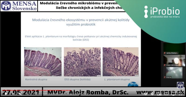 MENSA Slovensko o úlohe mikrobiómu pri podpore zdravia v prevencii vzniku a rozvoja chorôb