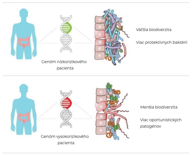 Syndróm dráždivého čreva ovplyvníme zmenou zloženia črevných baktérií