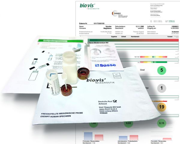 Molekulárno-genetické vyšetrenie mikrobiómu čreva zo vzorky stolice