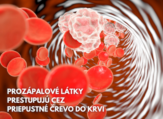 prozapalove latky LPS